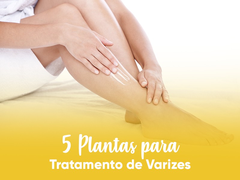 5 Plantas para Tratamento de Varizes